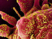 КОВИД-19 МОЖЕ ДА НАПРАВИ ИМУНИОТ СИСТЕМ ДА ГИ НАПАДНЕ СОПСТВЕНИТЕ КЛЕТКИ НА ЗАБОЛЕНИОТ