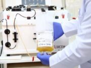 Во овие моменти најпотребна е солидарност: Институт за трансфузиона медицина апелира до оздравени од КОВИД19 да донираат крвна плазма