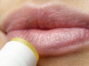 Како да се заштитите од појава на херпеси на уста во текот на есенскиот период?