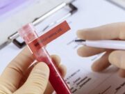 Корона математика: Пресметување на ризик од заболување