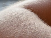 Која е функцијата на ежење на кожата и на што нашето тело реагира?