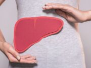 Причини за замастен црн дроб иако не конзумирате алкохол