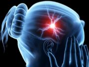 Мозочен удар: Ако ги имате овие симптоми итно на лекар