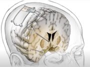 Најефикасната техника за подобрување на меморијата потекнува од античка Грција и се нарекува „Локус“