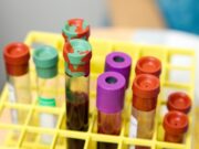 СЗО препорача ограничување на третман со крвна плазма кај пациенти со ковид